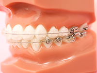 歯並びは見た目だけでなく、全身の健康にも影響します